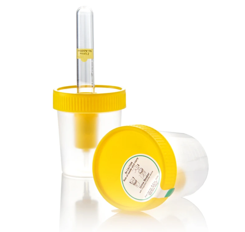 Ємність для збору сечі “ВОЛЕС” 100 (ml) мл стерильна